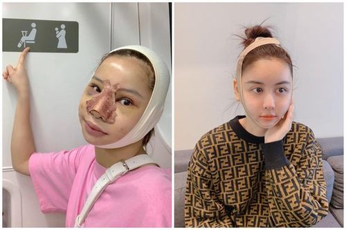 Tự tay đăng ảnh 'dao kéo', loạt hot girl Việt khiến CĐM hoảng hốt