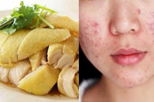 5 loại thực phẩm dễ khiến chị em bị rối loạn nội tiết tố, nên hạn chế sử dụng
