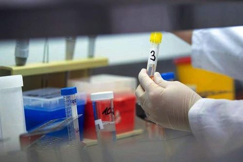 Bệnh nhân tử vong tại BVĐK Trung tâm An Giang không mắc COVID-19