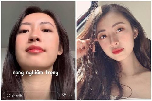 Khoe nọng cằm, bạn gái Rocker Nguyễn vẫn được khen hết lời