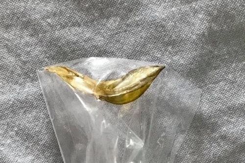 Người đàn ông 61 tuổi bị thủng thành ruột non do hóc xương cá
