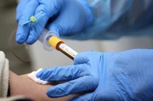 Bệnh nhân đầu tiên trên thế giới nhiễm COVID-19 hai lần, với hai chủng virus khác nhau