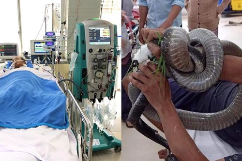 Người đàn ông bị rắn hổ mang chúa cắn đã được phẫu thuật vết thương, chuẩn bị ghép da