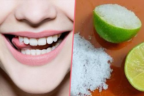 3 cách làm trắng răng bằng muối, chà đến đâu đánh bay mảng bám đến đó