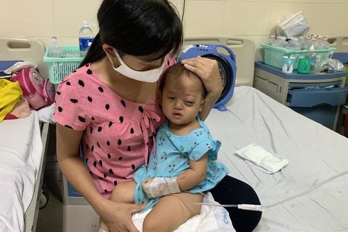 Người cha dân tộc nghèo bất lực nhìn khối u ở mắt của con gái 1 tuổi ngày một lớn
