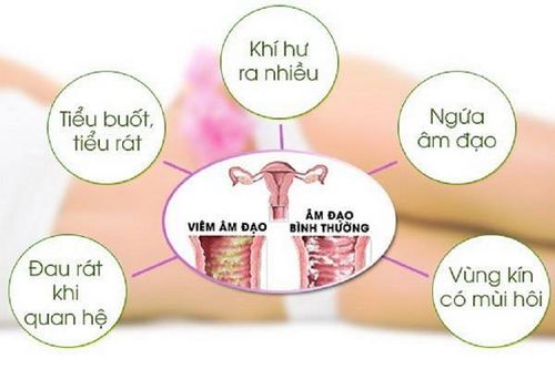 Viêm nhiễm phụ khoa, khi nào cần đi khám?