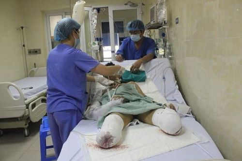 Hà Nội: Nạn nhân trong vụ nổ bình gas 'như bom' ở Đông Anh phải cắt cụt hai cẳng chân