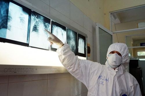 167 bệnh nhân COVID -19 đã cho kết quả âm tính với SARS-CoV-2