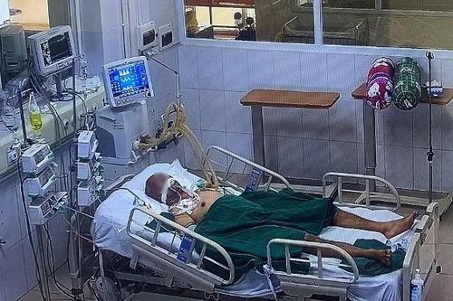 BN793 tổn thương phổi nặng, đang chạy ECMO