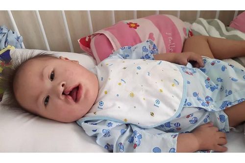 Bé gái 19 tháng tuổi mang nhiều bệnh hiểm nghèo