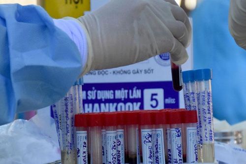 Ca tái dương tính với virus SARS-CoV-2 sau 18 ngày xuất viện