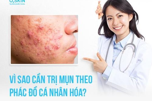 Vì sao cần trị mụn theo phác đồ cá nhân hóa?