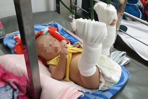 Nghiêm trị kẻ giận vợ đánh gãy chân con trai mới 4 tháng tuổi