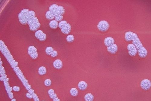 Chuyên gia lý giải nguyên nhân liên tiếp phát hiện ca Whitmore