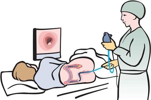 7 cách ngăn ngừa và phát hiện bệnh ung thư đại tràng