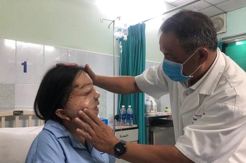 Cứu cô gái trẻ 22 năm mang 'khuôn mặt quỷ'