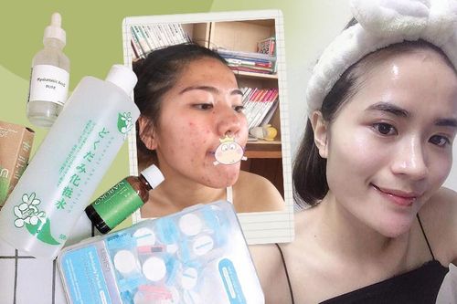 Nàng 9x chia sẻ 4 bước phục hồi da kèm review tường tận 7 sản phẩm tin tưởng nhất