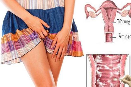 Ngứa bộ phận sinh dục nữ giới do đâu?