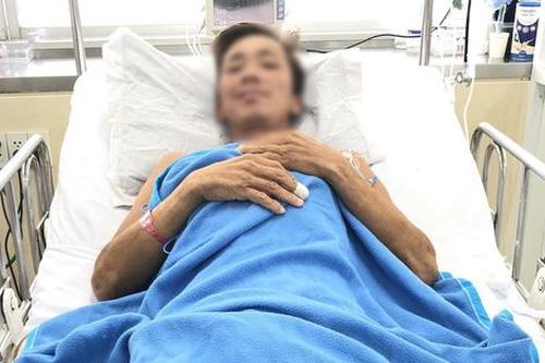 Người đàn ông bị rắn hổ mang chúa cắn sẽ phải qua nhiều lần ghép da để hồi phục mô hoại tử