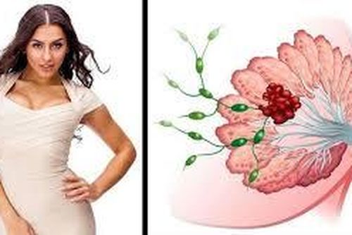 Những kiểu thời trang có thể gây nguy hiểm cho cơ thể bạn