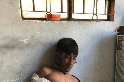 Trộm xe máy, trên đường bỏ chạy tông người dân gãy chân