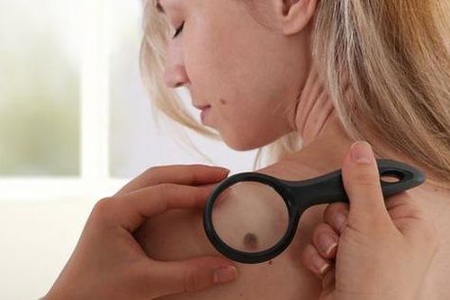 Bác sĩ cảnh báo một trào lưu trên TikTok 'nguy hiểm' có thể gây tổn thương da vĩnh viễn