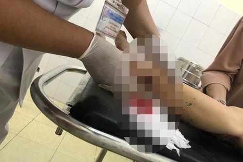 Chém hàng xóm do mâu thuẫn từ vật nuôi