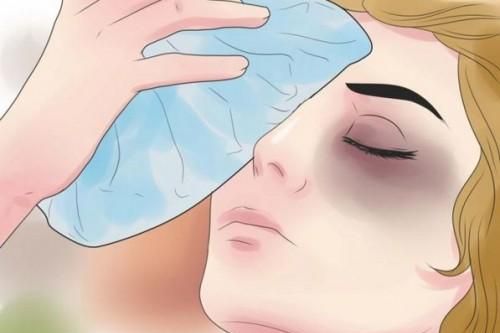 Xử trí và phòng ngừa một số tai nạn mắt tại nhà