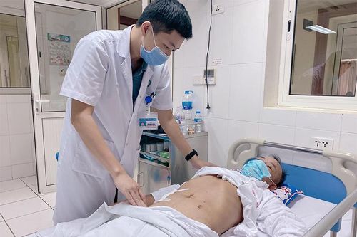 Bệnh nhân thủng ruột non do nuốt phải tăm
