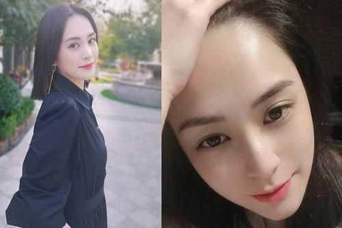 Chung Hân Đồng nhập viện vì chấn thương đầu nghiêm trọng