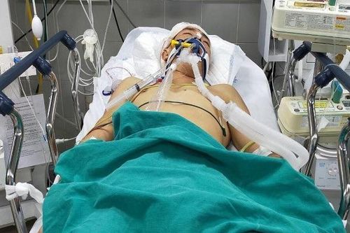 Xót xa cảnh chồng vỡ khối u não, vợ mang thai không có tiền đi đẻ