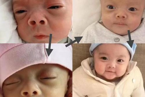Ngỡ ngàng với sự thay đổi của bé sơ sinh