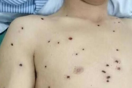 Hai thanh niên bị bắn gây thương tích
