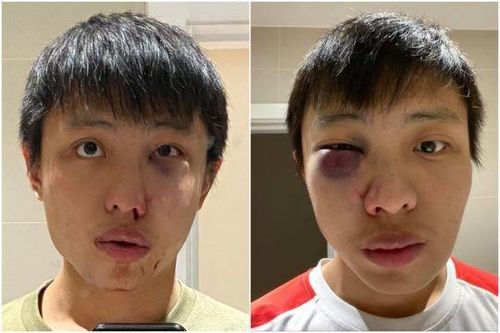 Giới trẻ châu Á đoàn kết để đối phó nạn kỳ thị