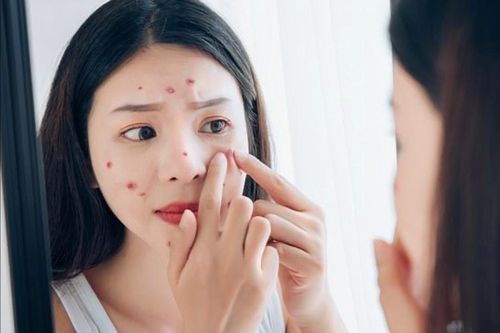 Nặn mụn trên mặt, thiếu nữ nhiễm trùng não nguy kịch