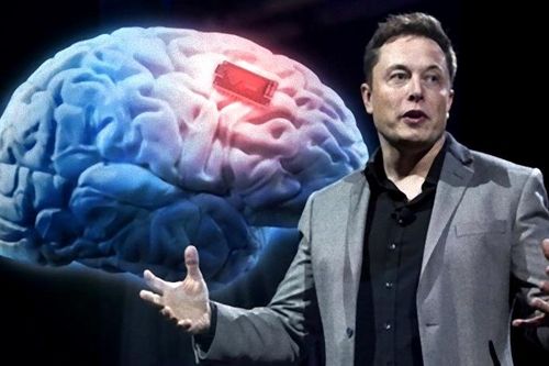 Tiết lộ cỗ máy cấy chip vào não người của Elon Musk