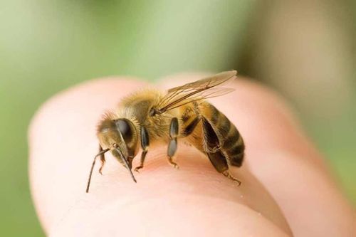 Bị ong đốt, bạn cần sơ cứu thế nào?