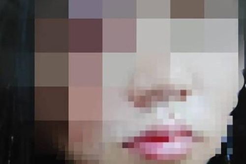 Người phụ nữ ôm gương mặt bê bết máu chạy đến bệnh viện, tiết lộ bi kịch bạo hành gia đình suốt 5 năm và suýt bị chồng chôn sống
