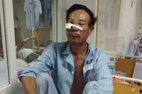 Giáng búa vào mặt hàng xóm