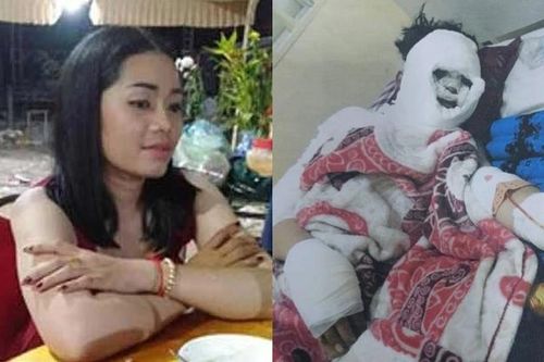Gã 'ác quỷ' tạt axit, chặt tay bạn gái vì 'đòi chia tay'