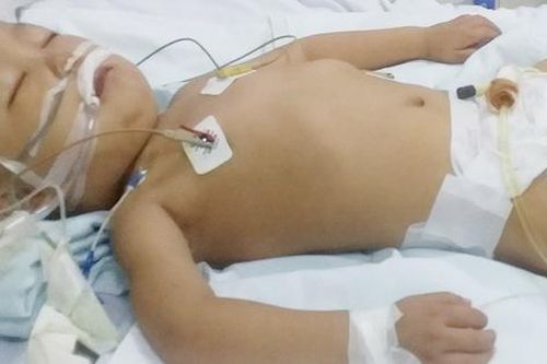 Sau bữa ăn tối, bé trai 4 tuổi đang mắc ung thư máu bỗng suy đa tạng, hôn mê suốt 2 tháng, đối mặt với tử thần