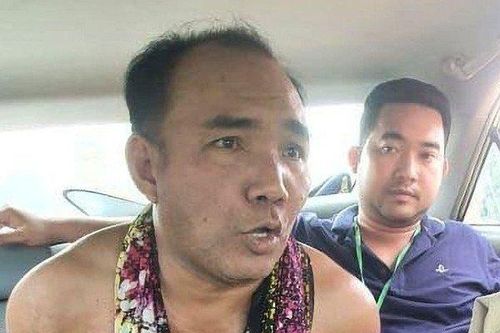 Người đàn ông tạt axit, chém lìa tay bạn gái vì không chấp nhận chuyện chia tay