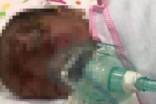 Phát hiện một bé trai khoảng 3 ngày tuổi bị bỏ rơi ven đường, trên mặt có nhiều vết xước