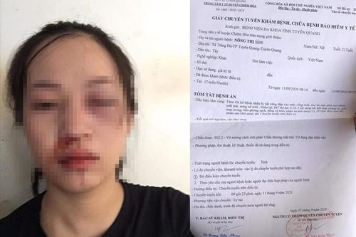 Công an lên tiếng vụ CSGT bị tố vụt gậy vào mặt người vi phạm