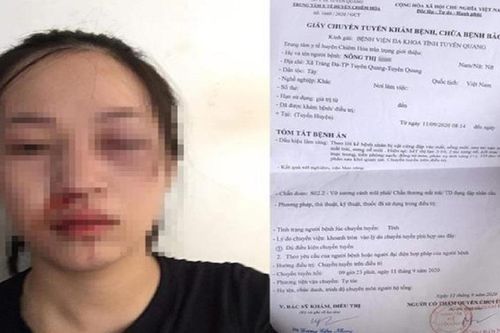 Xác minh thông tin người phụ nữ tố bị CSGT vụt gậy vào mặt