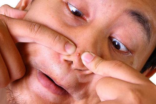 Nhiễm trùng nội sọ do nặn mụn sai cách ở vùng tam giác chết trên mặt