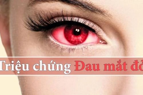 Khó chịu với đau mắt đỏ