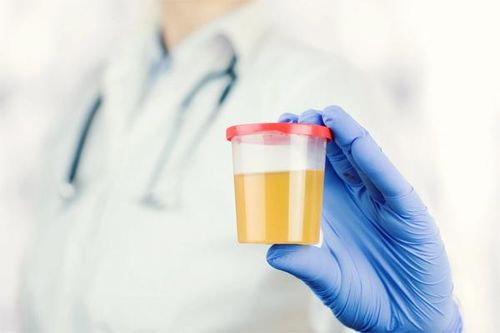 Đoán bệnh qua màu nước tiểu bất thường