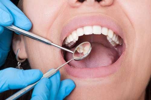 Thấy miệng có dấu hiệu này hãy tới bệnh viện ngay kẻo hối hận chẳng kịp