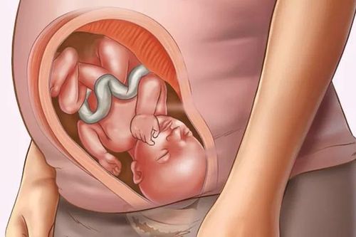 Những dị tật bẩm sinh ở bé mà mẹ bầu nên biết